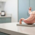 Strategie per Sfiammare la Mucosa Gastrica