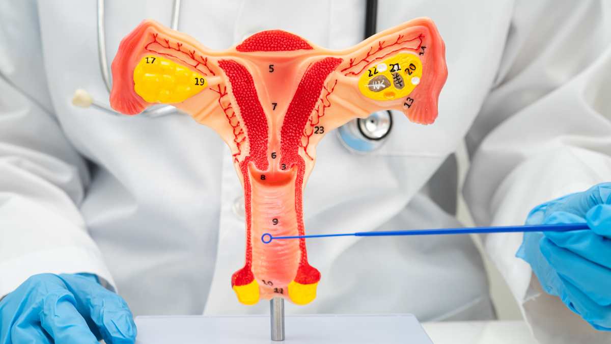 secchezza vaginale, infezione vaginale
