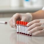 Cosa fa addensare il sangue: cause, fattori di rischio e possibili conseguenze
