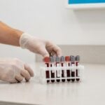 Quali esami fare prima di iniziare una dieta per dimagrire in sicurezza