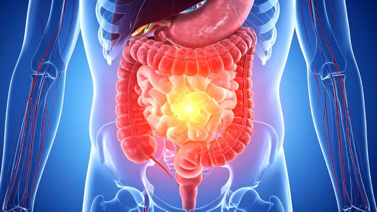 Cosa mangiare per sfiammare stomaco e intestino