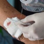 Cosa mettere su ferite da sfregamento