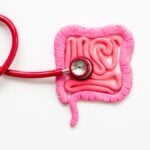 blocco intestinale