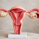 Il tuo ciclo è così abbondante? Quando correre dal ginecologo