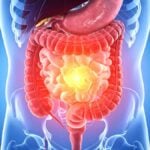 intestino