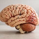 Il trapianto di staminali nel cervello può davvero migliorare i sintomi del Parkinson e ridurre i farmaci dopaminergici? Quali risultati concreti sono stati osservati nei primi 12 mesi di follow-up?