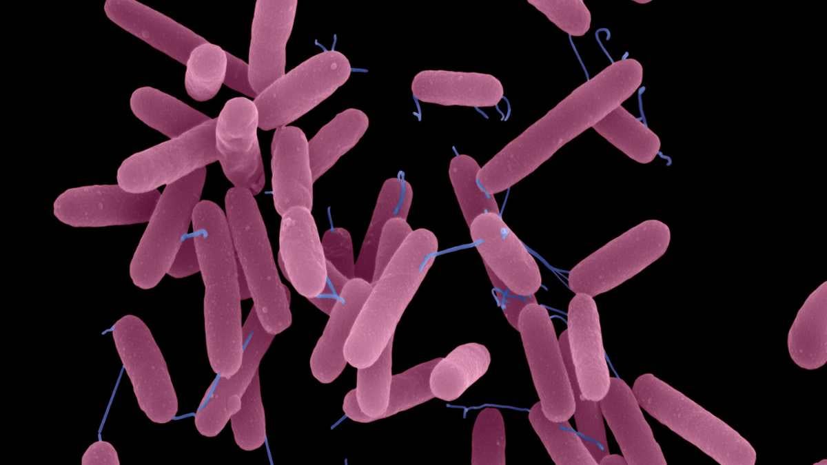 pseudomonas aeruginosa