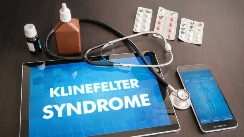 sindrome di klinefelter