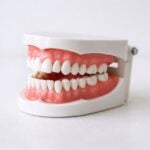 Mal di denti fortissimo? Evita gli oppioidi: cosa prendere subito