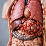 Hai meno di 40 anni? Ecco perché il tumore ti riguarda già