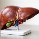 Fegato grasso nei bambini con sovrappeso: quando sospettarlo e quali esami chiedere al pediatra